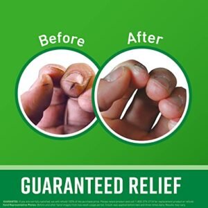 O’Keeffe’s Working Hands Hand Cream for Extremely Dry, Cracked Hands, 3.4 Ounce Jar, (Pack 2)